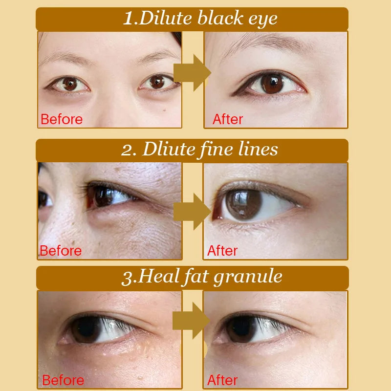 20Pcs Crystal Collagen Gold Eye Mask Anti-Aging Dark Circles Acne Beauty Patches For Eye Skin Care Cosmetics